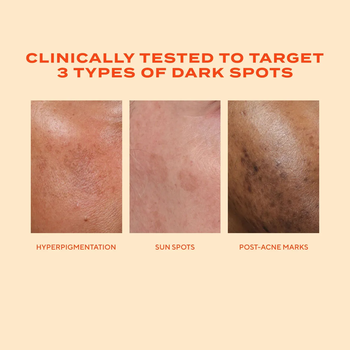 Serum Murad giảm thâm nám Rapid Dark Spot Correcting 30ml - Ảnh 6