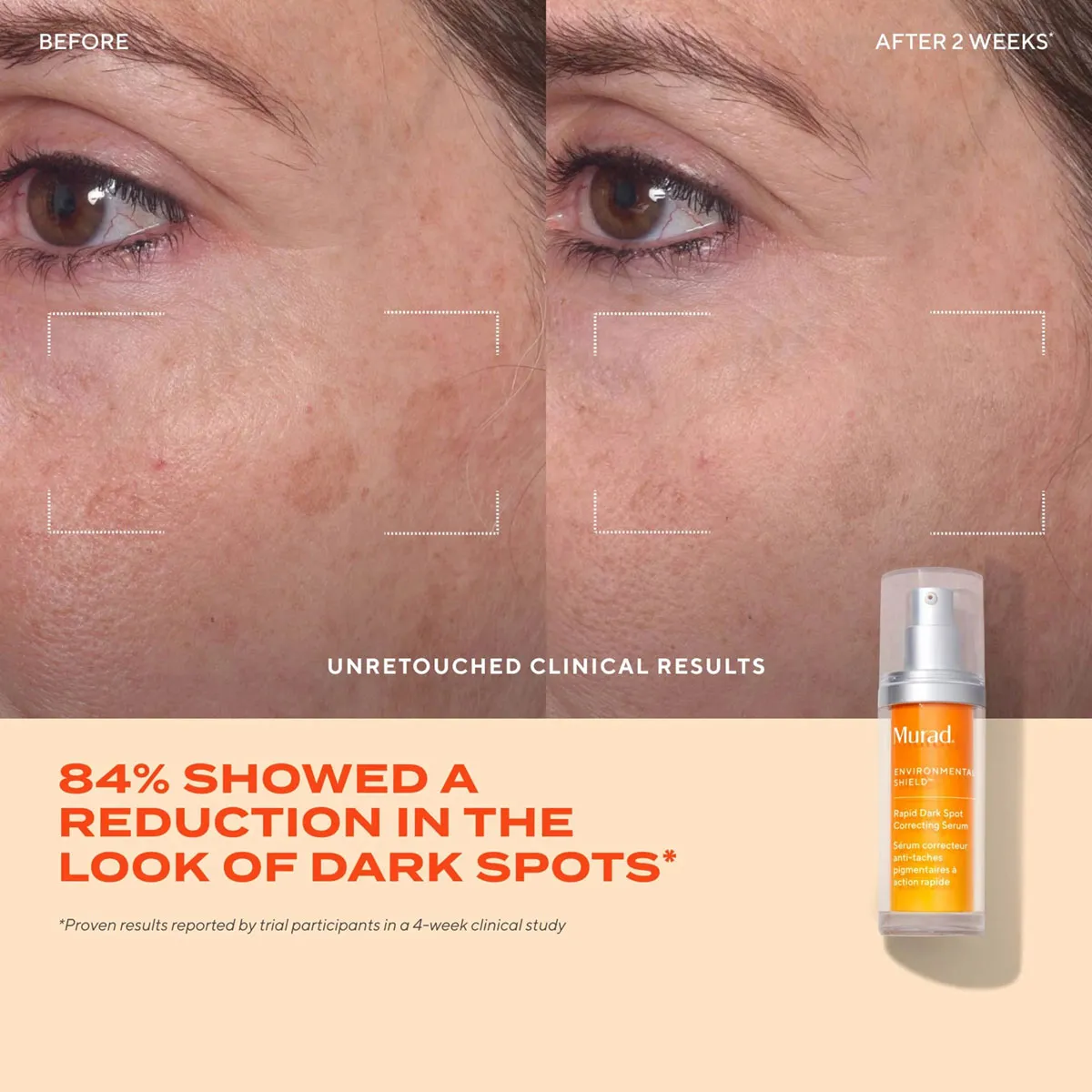 Giới thiệu Serum Murad giảm thâm nám Rapid Dark Spot Correcting 30ml  Giới thiệu Serum Murad giảm thâm nám Rapid Dark Spot Correcting 30ml