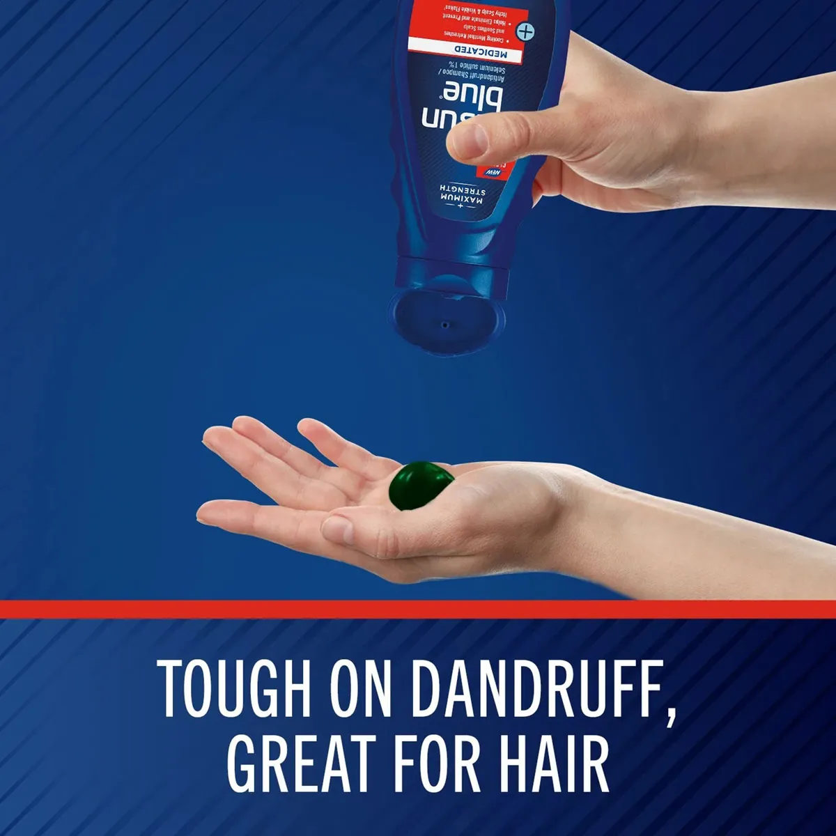 Giới thiệu Dầu gội trị gàu Selsun Blue Medicated Shampoo 325ml Mỹ
